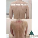 찜케어 | [공지] [충주다이어트] 젤라뷰티크 웨딩케어 체형관리후기