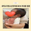 명소아과의원 | 부산 연지동 초읍 소아과 [새싹소아청소년과의원] BCG 피내용 접종 + 1차 영유아검진 후기