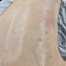 라미온 | 울산 달동 에스테틱 라미온뷰티 바디관리 후기
