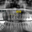 범어도담치과의원 이미지