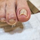 네일크루 | 성남 미금역 내성발톱 받자마자 편안해지는 네일다움 페디크루 후기