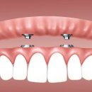 연세푸른치과의원 이미지