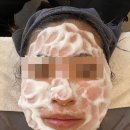 기가모터스 | 용인피부관리 구성역 헤세드힐 홍조관리 받고 온 후기 데콜테까지 완벽했던 곳