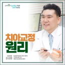 죽전아름다운치과의원 | 죽전치과, 치아교정 미니스크류, 악궁확장 장치 언제 필요할까?