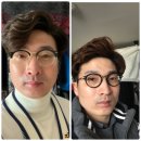 파이진글로벌 볼륨톡스 후기