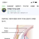 눈 안에 속눈썹 들어갔는데.. 눈 깜빡하니까 사라졌다!!! 속눈썹은 어디로 가는걸까? 이미지