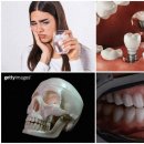 연세청천세브란스치과의원 | 치아 건강 지키는 법 오해와 진실, 와인 후 관리, 교정 후 관리법