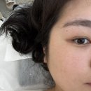 리안에스테틱 - 중구 동덕로6길 16 | 동탄 청계동 피부관리 리안에스테틱에서 MTS 관리 후기!