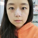 (주) 덕인메디칼 | 대구 남산역 아미뷰티 플라즈마 블라스트 체험리뷰:)