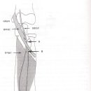 원회내근 정중신경 압박과 전골간증후군(Pronator Teres Median Nerve Compression and Anterior Interosseous syndeome) 이미지