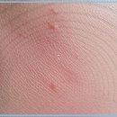 미엔느의원 | 민감한 피부 값싼 화장품이 독 될 때