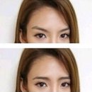 뷰티라이트 이미지