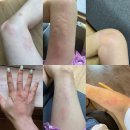 쁘띠돌스❤️ 내 뱃속 뚱보균🐷+숙변💩시원하게 내보내는 일등공신! 닥터클린톡 1+1 / 2+3 공구!