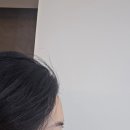 유앤미의원 | 이마 필러 유앤미의원 방문 후기 │ 줄기세포 베베필로 자연스러운 이마 볼륨 케어 내돈내산 9일차 솔직...