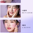 피부 상처 감염이 가장 위험한 TOP5 신체 부위별 치료 방법