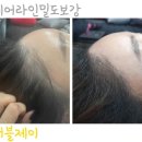 기장 정관 양산 여성헤어라인&두피문신 잘하는곳 어디?★더블제이★+후기추가샷입니다! 이미지