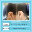 맑은보청기 이미지