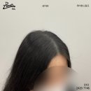 레이븐스칼프