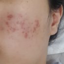 닥터이레이저피부과의원 이미지