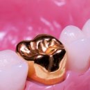 골드크라운 이미지