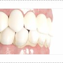 서면뉴욕치과의원 이미지