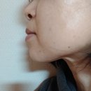 딥스킨 | 포트리스킨 클렌징오일<아로마 딥 클렌징오일> 후기