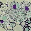 한국춘란과 균근균(菌根菌-mycorrhiza)15/뿌리와 내생균근균(內生菌根菌)08/난균(蘭菌)5(한난이346) 이미지