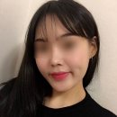 민트성형외과의원 네이버블로그