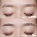 뉴뷰티클리닉