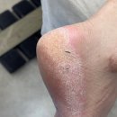 오학 | 보송보송한 발이 된 여주 발관리 잘하는 푸스케어 오학점 후기