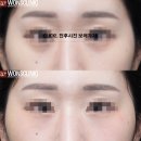 민트성형외과의원 티스토리