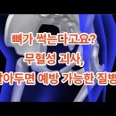 뼈가 썩는다고요? 무혈성 괴사, 알아두면 예방 가능한 질병 이미지
