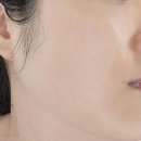 율무네 | 엠제이 올스킨케어율무세럼 기미 흑자 피부관리 세럼추천 후기