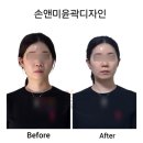한우리화장품 | 대전윤곽관리 탄방동 비대칭관리 팔자주름 두골비 손앤미
