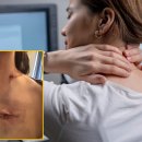 “자세 탓에 어깨 결린가 했는데”…간 폐까지 전이된 유방암 4기였다고? 이미지