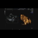 효성목욕탕 | 임신중기, 27주차~32주차 / 아기 맞이 준비를 시작하는 일상 기록_입체초음파, 울산 최저가 백일해...