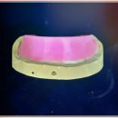 장인치과기공소 이미지