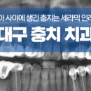 정평탑치과 네이버블로그