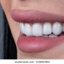 선플란트치과의원 이미지