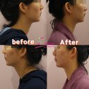 경락마사지 이미지