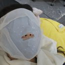 본라인의원 | 선릉역 본라인의원 인디고 리프팅 턱선 살리기