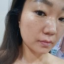 루시아 피부관리 이미지