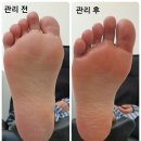 로제네일 이미지