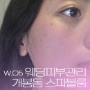 블룸 | w.05 웨딩 피부관리 / 개봉동 🌟스파블룸🌟 로즈필링 후기