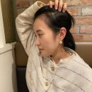 김헤어라인 | [공지] 헤어라인모발이식후기 40대 여자 6개월 경과 + 암흑기