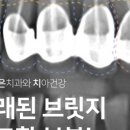 영도조은치과의원 네이버블로그