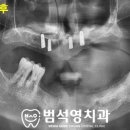 범석영치과 이미지