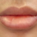 에르샤몽 연세강남의원 이미지