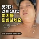 프롬영네일 | 포항데콜테마사지 후기 | 붓기가 안 빠진다면 순환부터 확인해보세요