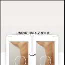 피부관리(바디) 이미지